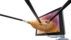 外科用手術用3Dビデオスコープのイメージ
